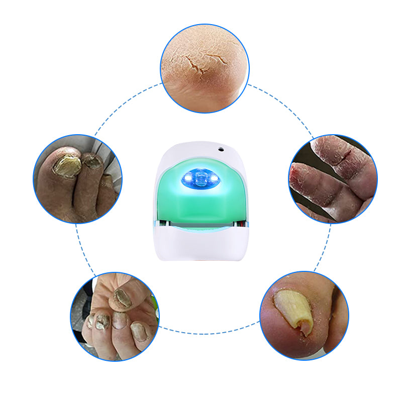 Toenail Fungus Laser Therapy Device for Onychomycosis and Nail Fungal Laser Device